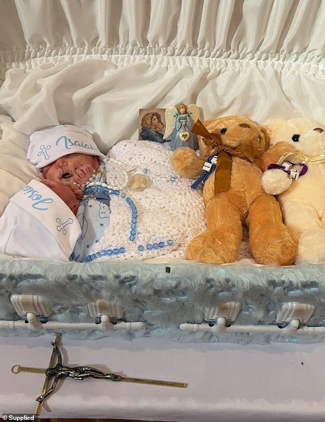 The deceased twins were given an open-casket funeral service and then buried on Thursday, eight days after their birth and tragically short lives.