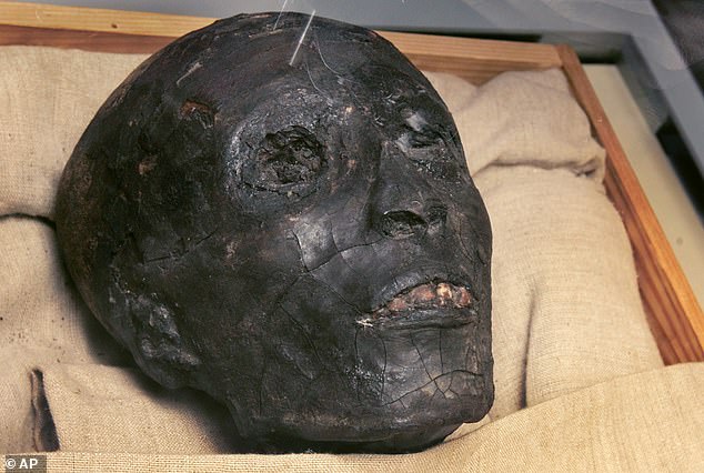 King Tutankhamun died at just 19 years old from an infection that researchers believe stemmed from a broken leg