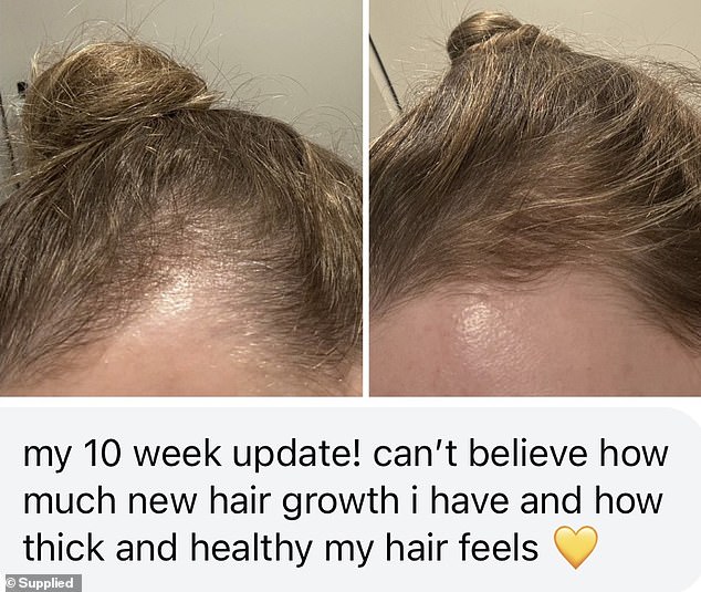 One woman noticed improved thickness of her hair after 10 weeks of using the scalp serum