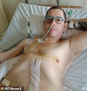 Dr. Kraut, pictured after surgery, is now suing doctors for not finding the tumor sooner