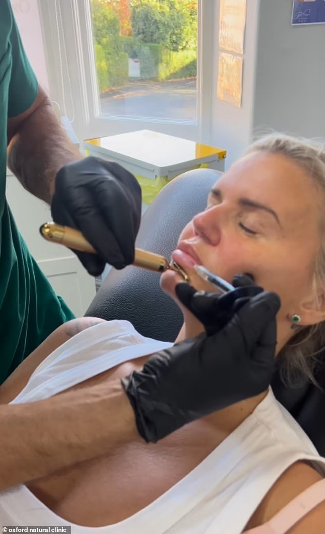 A clip of the process was shared to Instagram on Wednesday, showing Kerry on a reclining treatment chair as she received the 'natural' treatment