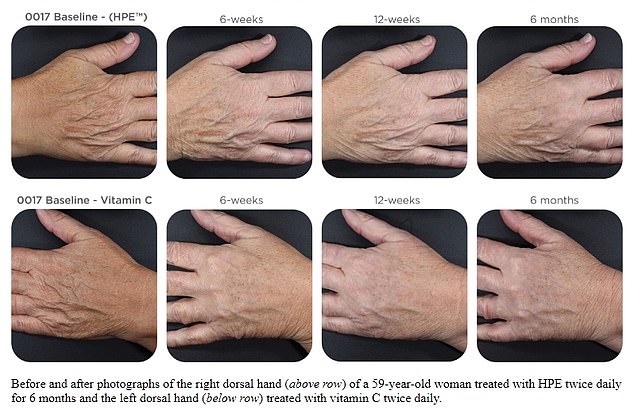 The images above show the hands of a 59-year-old volunteer - as above, she applied the expensive serum to her right hand (top row) and the budget serum to her left (bottom row). The cheap product was better at reducing common signs of aging, including age spots and wrinkles