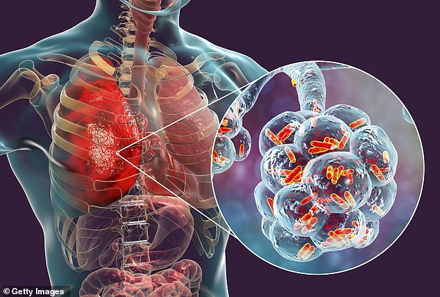 Researchers tested how berry and unflavored vapors affected immune cells in our alveoli (illustrated) by exposing mice to continuous e-cigarette vapor for 10 days