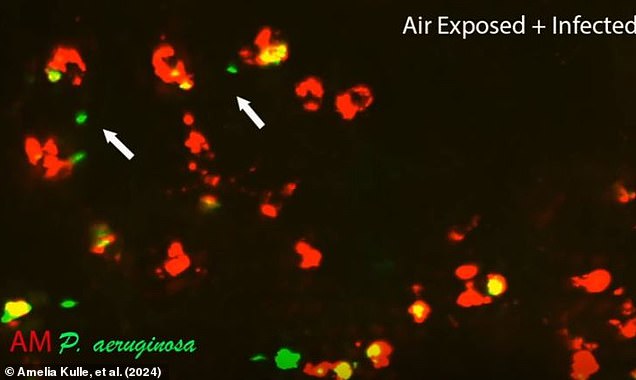 When the mice were exposed to bacteria, the healthy cells moved quickly to engulf the pathogens (photo)