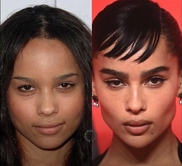 Zoe Kravitz is seen above in early 2010, and again in 2017. Surgeons also suggest she had surgery to remove her belly fat.