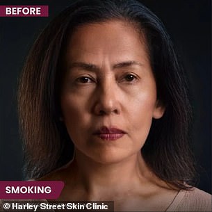 The above is an AI-generated image showing how smoking can affect a person's physical appearance