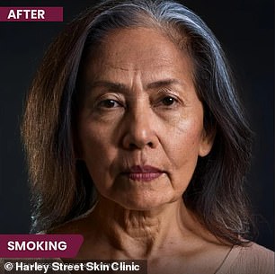 The above is an AI-generated image showing how smoking can affect a person's physical appearance