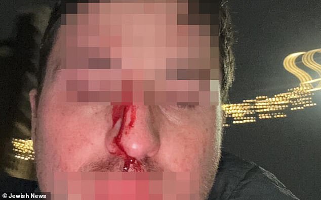 A British Jewish man, known only as Aaron, was left with blood running down his face after intervening to help an Israeli football fan avoid being attacked by an anti-Jewish gang in Amsterdam on Thursday evening.