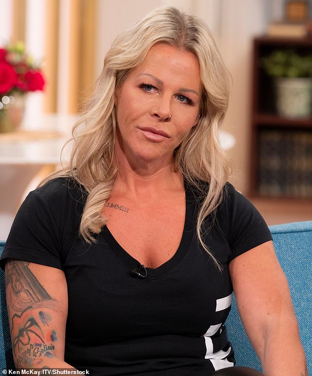 Michelle Heath (pictured) appeared on This Morning in April to talk about her horror plastic surgery that has left her scarred for life