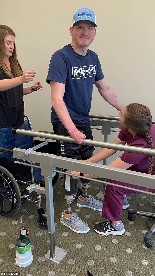 Mr Riley was fitted with a prosthetic leg on a Friday in May. The following Monday he had to tackle curbs and steps. He has recently returned to some of his hobbies, such as bowling