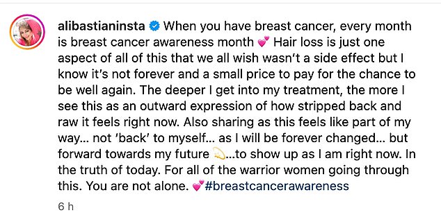 She wrote: 'Hair loss is just one aspect of all this that we all wish wasn't a side effect but I know it's not forever and it's a small price to pay for the chance to get better again '