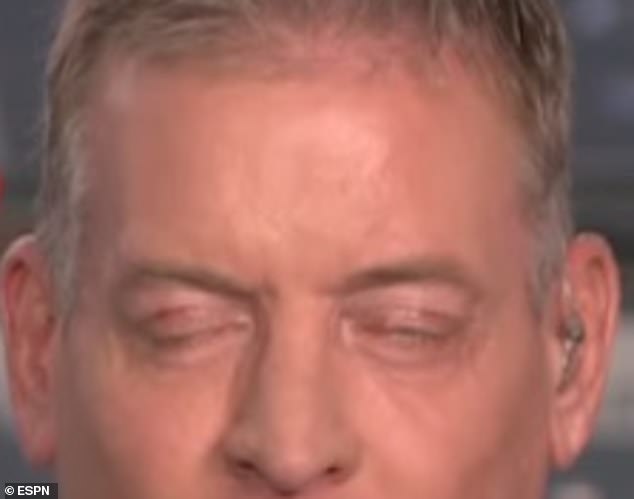 There appeared to be dried blood on Aikman's eyelids when he appeared on ESPN