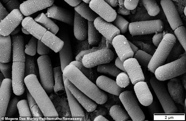 Electron micrograph of Bacillus cereus, which can produce poison that causes fever, vomiting, abdominal pain and diarrhea