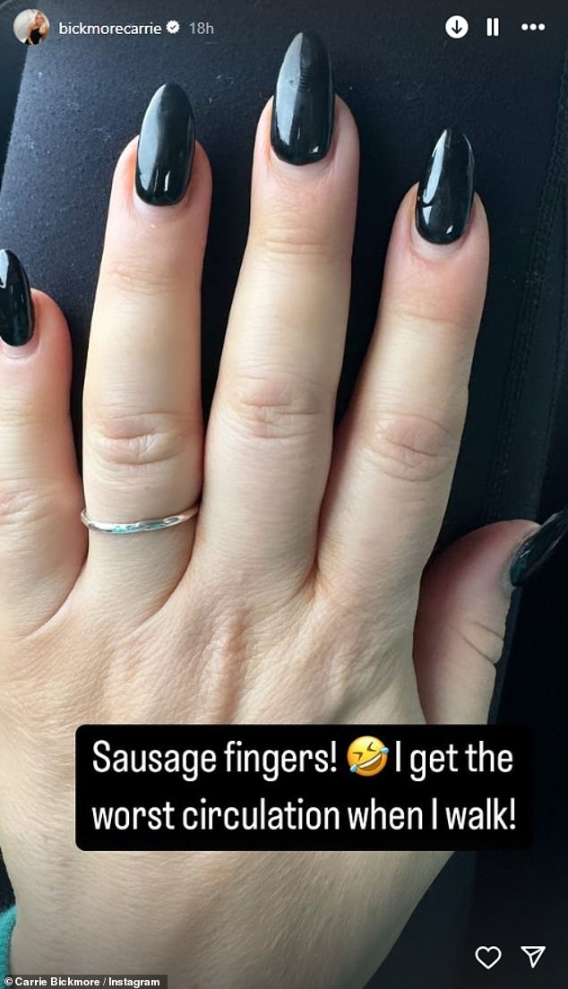 'Sausage fingers!' Bickmore wrote next to an image of her very swollen hands. 