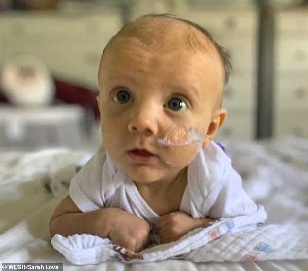 Lincoln underwent two surgeries, which kept him in the hospital for more than a month, and the toddler was later diagnosed with a rare genetic condition known as Alagille syndrome.