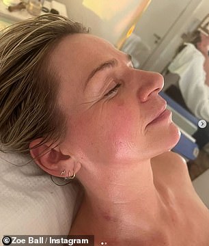 Zoe uploaded a photo of herself after before (left) and after getting a facial to relax the muscles: 'I have TMJ and wake up most days with a horrible headache from tension and jaw clenching'