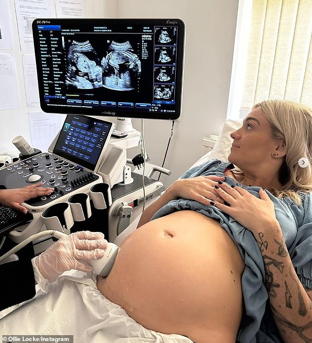 Before their surrogate mother Bex Ward welcomed their son and daughter in July 2023, the couple suffered two miscarriages, one when she was six weeks pregnant in 2021, with their first surrogate.