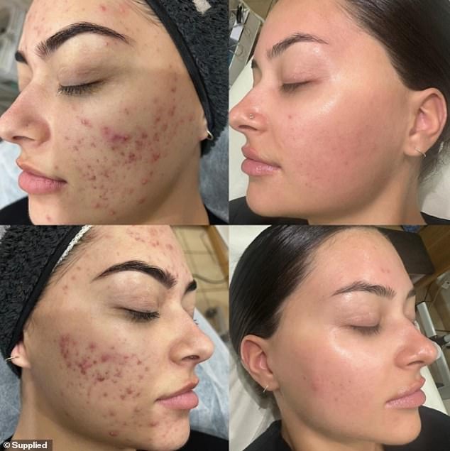 Impressive results: A woman who used the Aesthetics Rx Total DNA Serum alongside a number of professional treatments and other products in a skin care regimen showed glowing skin