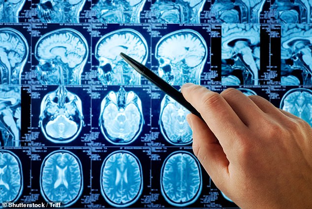 Lord Darzai, who recently carried out a major review of the NHS, said there will come a time when AI is used to quickly detect all cancers (stock image)