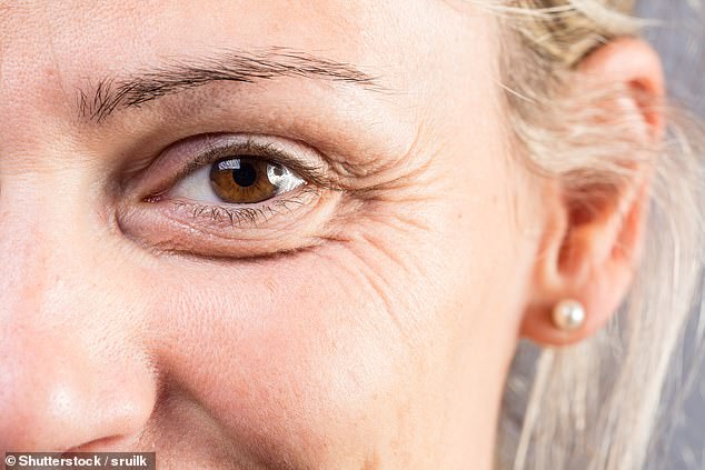 Too many crow's feet could be an early sign of dementia, according to academics (Stock Image)