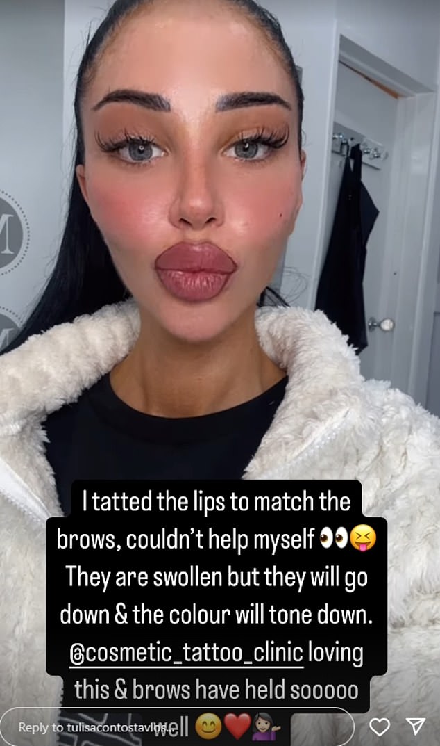 N-Dubz singer Tulisa, 36, shared on her Instagram stories that she had the outline of her lips tattooed and they looked quite swollen