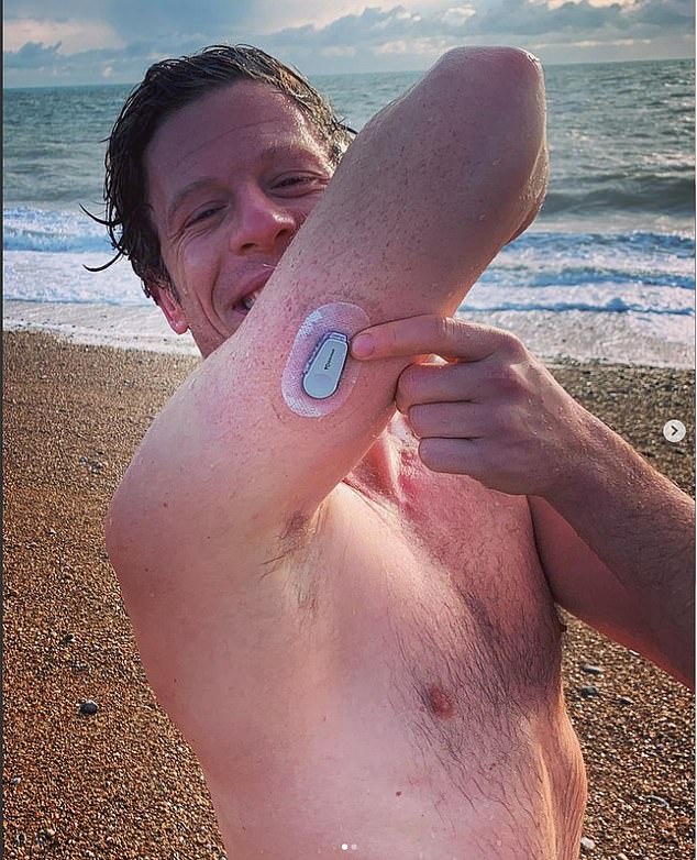 TV star James Norton was diagnosed with type 1 diabetes at the age of 22. He wears an implant that monitors his blood sugar levels 24/7 and warns him of dangerous crashes.