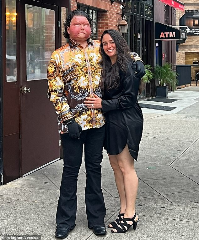 A man who underwent the world's first face and double hand transplant has shared his adorable engagement photos online