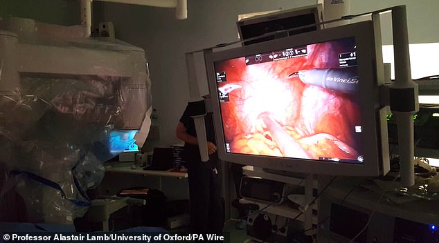 A cancer patient undergoing robot-assisted surgery. The robotic operation could reduce the risk of severe incontinence in prostate cancer patients