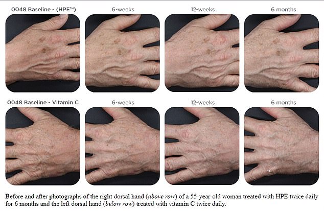 The images above show the hands of a 55-year-old volunteer: she applied the expensive serum to her right hand (top row) and the budget serum to her left (bottom row). Photos were taken at the start of the trial, and at six, twelve and 26 weeks