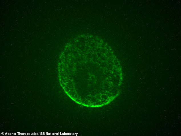 Scientists on the International Space Station (ISS) have grown brain-like organoids in space to investigate new treatments for Alzheimer's, Parkinson's and spinal cord injuries