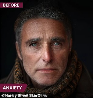 The above is an AI-generated image that shows how stress can affect a person's physical appearance over time