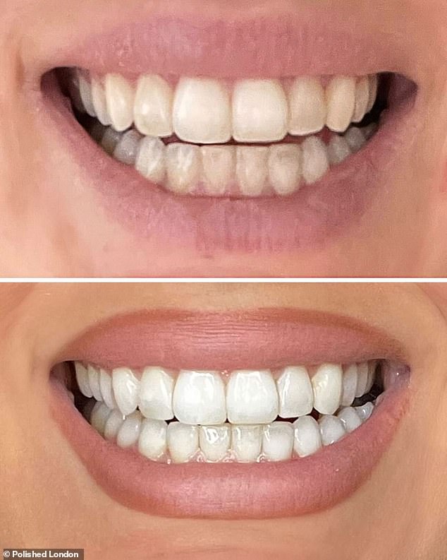 Many users said the easy-to-use powder 'feels like a professional dental cleaning', leaving their teeth 'pearl white' and noticeably brighter