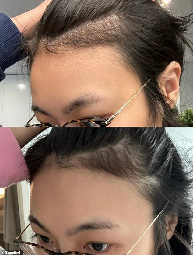 Women struggling with hair loss rave about TYPEBEA Overnight Boosting Peptide hair serum after noticing incredible results after just four weeks of use