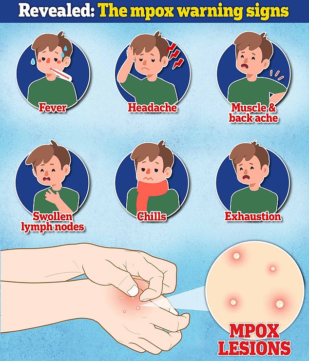 1733205395 405 Expert reveals most missed sign of ultra deadly MPox strain to