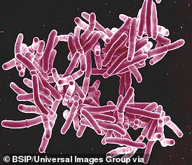 In the photo: the mycobacterium that causes tuberculosis