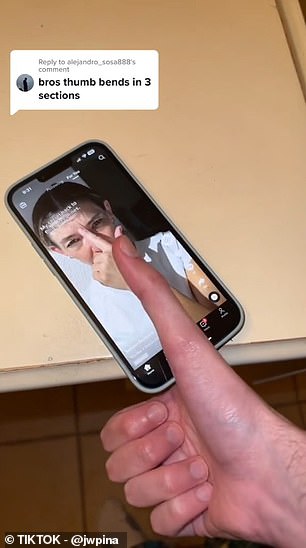 Mr. Pina has gone viral on TikTok for his thumb, showing clips comparing it to other objects. The photo above shows him trying to use his cell phone with his thumb extended