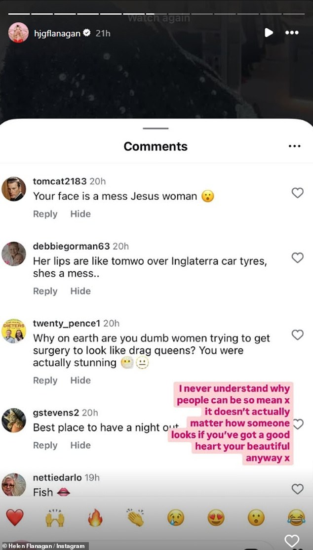 Helen took to her Instagram Stories on Sunday evening where she shared a glimpse of some of the hateful comments she received, including one who said her lips looked like a 'baboon's a**'