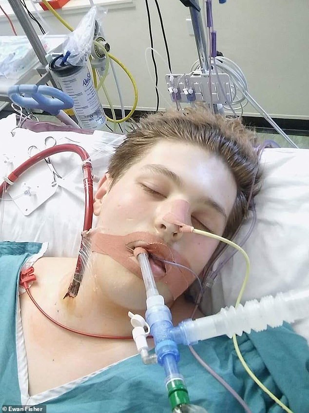 A famous example of a vape allergy is that of Ewan Fisher who almost died at the age of 16 from an extreme reaction in which the air sacs and airways in the lungs became severely inflamed.