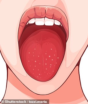 A pink tongue may indicate that your taste buds are reacting poorly to certain foods, to stress, or even to a deficiency of a vitamin such as folic acid or B12.