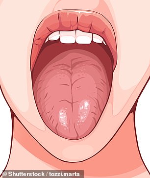 Those with ridges or indentations in their tongues simply result from genetics