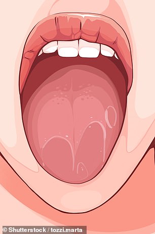 A tongue may develop mild swelling after a reaction to a very hot cup of coffee or if you accidentally bite your tongue instead of your food