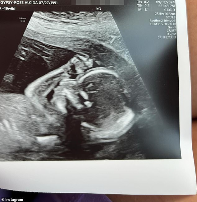 In September, the Louisiana native took to her Instagram page to share a 20-week ultrasound showing her baby girl