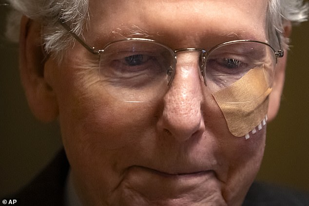 Senate Minority Leader Mitch McConnell of Kentucky wears a bandage on his face as he walks to cast a vote on the Senate floor after falling during a luncheon on Capitol Hill