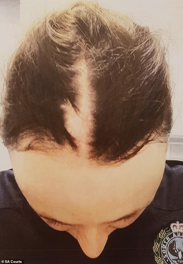 The court heard Cruise carried out a violent attack on Constable Anthea Beck outside the Exeter Hotel in Adelaide, leaving the officer with a large section of hair torn from her scalp (pictured)