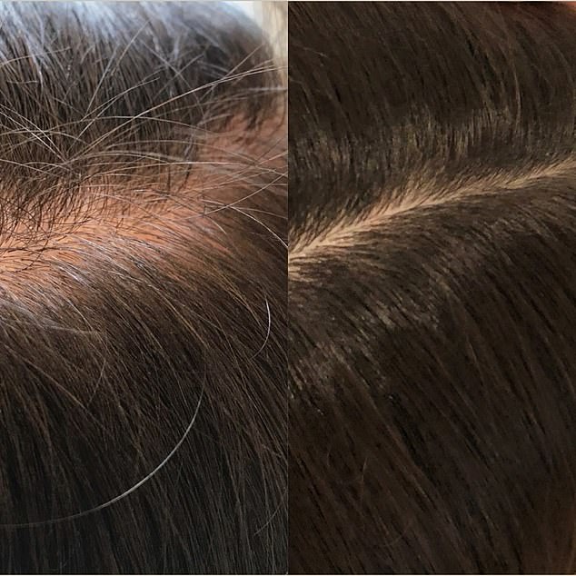 The supplement was created to address a number of hair concerns, including thinning, fine or dull hair and hair loss, and customers have shared impressive results