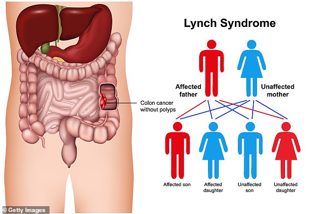 Lynch syndrome significantly increases the risk of numerous forms of cancer at a young age