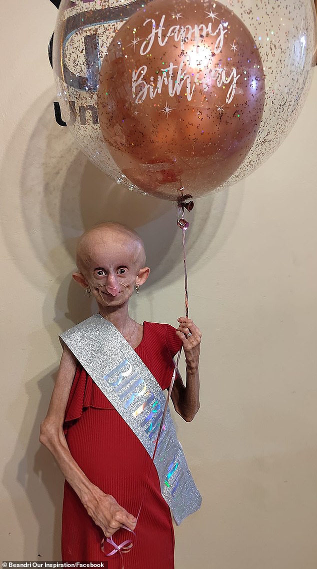 Beandri from Pretoria, South Africa, wasn't expected to live past the age of 14, but refused to give up and became an internet sensation with more than 269,000 followers