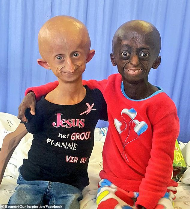 Beanadri with fellow sufferer Ontlametse Phalatse. The two were close friends before Phalatse died from the mutation last year at the age of 18, becoming the only black patient in South Africa.