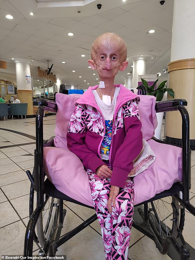 Only one in four million babies are born with the incurable condition and Beandri was just one of 200 known sufferers in the world and the last patient in South Africa to die from the condition.