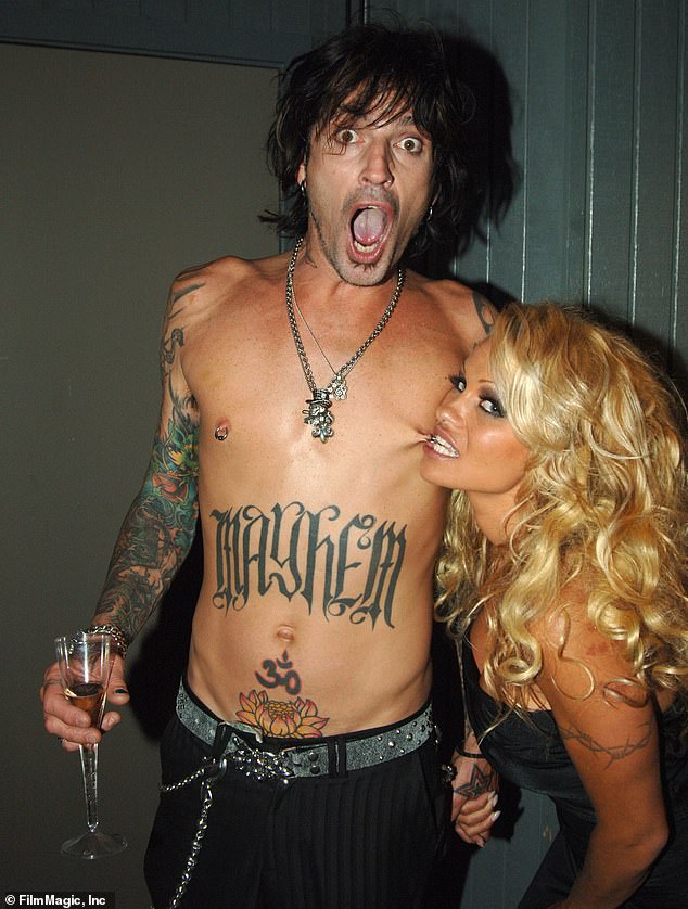 Furlan said the musician only showers “once a week”; Tommy pictured with ex-wife Pamela Anderson in 2005